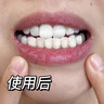 维特丝美亮白牙贴炫白牙齿去黄去渍清新口气口腔异味温和不酸牙磨牙贴片 实拍图