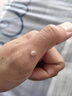 DRVIALY祛疣灵扁平疣丝状疣面部非药膏专用脖子颈瘊子去疣克疣跖膏疣神器 5盒装【疣体灭绝-德国特效果】 实拍图