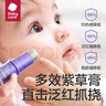 babycare紫草膏婴儿儿童止痒棒1分钟舒缓6g/1支+植萃防护贴36贴 实拍图