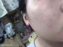 THE ORDINARY10%烟酰胺+1%锌提亮控油淡痘印精华60ml礼物女生 实拍图