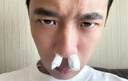 御医匠鼻炎鼻贴过敏性鼻炎鼻窦炎贴鼻塞鼻痒治根穴位贴儿童成人专用膏药 【单盒装】 实拍图