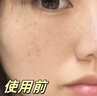 维特丝面膜美白补水保湿淡斑男女士去黄气提亮肤色暗沉紧致抗皱熬夜修复 实拍图