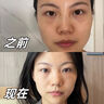OHBT黄芪面膜10片抗皱紧致抗衰老补水熬夜焕白淡斑女男士金榜第1名 实拍图