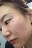 岩井昃弘去痣点痣膏药水专用脸部不留疤祛斑点斑儿童成年人疣祛黑痣去肉粒 升级点痣套装1盒【日本无痛无痕 美容院同款神器正品修复液进口除 晒单实拍图