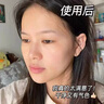 E'YEARN美白水乳套装淡化黑色素保湿舒缓修护烟酰胺祛斑美白水乳 一盒装 实拍图