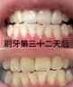 葵花美白牙膏去口臭去黄去牙渍烟渍牙垢热销金榜第一名牙膏亮白 1支【7天去渍-店长亲测】 实拍图