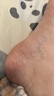 凡士林婴幼儿修护晶冻100g 宝宝润肤身体乳护臀膏 保湿滋润防干裂 实拍图