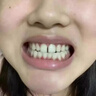 香港大药房有限公司医用脱敏牙膏龈萎l缩专用修复再生牙膏非凡抗防固牙齿护龈剂松动 实拍图