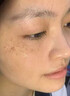 透真377美白祛斑面霜淡化黑色素黄褐斑雀斑提亮去黄男女士保湿霜 实拍图