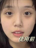 Newliann医用眼膜贴提拉紧致抗皱淡化细纹黑眼圈去眼袋眼贴膜眼纹胶原蛋白 实拍图