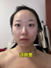 沃森博士皮傲宁祛痘膏修复痘印控油淡化去痘坑面霜去闭口青春痘学生 实拍图