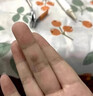 DRVIALY祛疣灵扁平疣丝状疣面部非药膏专用脖子颈瘊子去疣克疣跖膏疣神器 5盒装【疣体灭绝-德国特效果】 实拍图