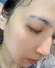 儒意（RUYI）水杨酸面膜20片祛痘淡痘印果酸控油清洁收缩毛孔女男士补水青少年 实拍图