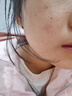 久卜制药烟酰胺凝胶医美用去斑去黑色素沉淀祛斑美白淡斑淡化黑色素霜1盒 实拍图