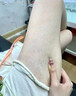 同仁堂妊娠纹修复产后去除预防孕妇专用肥胖纹生长纹医用退热凝胶 20g 实拍图