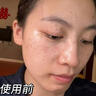 透真377美白精华液次抛淡化黑色素祛斑去黄提亮改善暗沉肤色烟酰胺女 实拍图