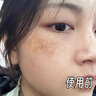 奈皙日本377烟酰胺美白祛斑霜淡化黑色素去雀斑老年黄褐斑面霜男女士 实拍图