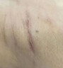 秀碧疤痕膏【德国原装】伤疤刀疤剖腹产 儿童凹陷增生去疤膏 身体护理 大支30g*1支 德国原装-非港版 实拍图