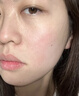 维特丝愈创木祛痘精华控油修护保湿淡化痘印去痘痘收缩毛孔男女士护肤品 实拍图