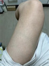 示博士鸡皮肤疙瘩搭毛囊角化症专用的药去角质大腿手臂去除神器特傚膏用 三套【中度鸡皮】鱼鳞皮蛇皮疙瘩 搭身体乳去鸡皮毛囊角质疙瘩品用 实拍图