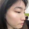 SUMDOY日本进口祛痘膏精华液淡化痘印痘坑去痘印修复红肿痘疤男女士凝胶 【红肿痘克星】一抹见效30g 实拍图