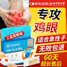同仁堂鸡眼贴护理盒 鸡眼膏手部去脚后根肉刺刺猴疣无刺痛脱落 三盒装 实拍图