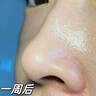 东洋之花硫磺洗面奶控油净透洁面乳去黑油收缩毛孔祛痘控油温和清洁洁面乳 【二瓶】实惠装 实拍图