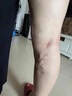 共勉然共勉山美共勉官网旗舰正品青筋凸起静A脉曲张蚯蚓腿下肢酸胀 4盒（买3盒送1） 晒单实拍图