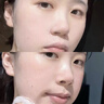 OHBT水杨酸祛痘面膜10片祛痘印修复痘坑毛孔收缩补水金榜第1名女男士 实拍图