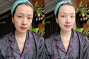 透真美白祛斑精华液377淡斑去黑色素提亮vc精华577抗皱补水保湿次抛 实拍图