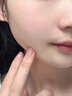 Newliann医用黑面膜械字号祛痘祛痘印术后消炎修复医美美白补水修护男士女 实拍图