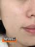 Novella那绯澜水杨酸精华乳30ml 收缩毛孔控油淡化痘印生日礼物日本进口 实拍图