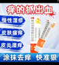 曲安奈德益康唑乳膏真菌感染脚气皮肤药抗真菌股癣专用药膏大腿内侧痒止痒抑菌皮肤瘙痒皮炎湿疹脱皮烂脚丫药 1盒【脱屑掉屑红斑瘙痒】*15.g赠棉签 实拍图