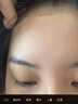 医用精华液械字号收缩毛孔粗大修复细致去黑头粉刺闭口男士女士祛痘印黑色素沉淀控油淡化痘印痘坑透明质酸钠 实拍图