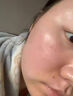 透真油橄榄修复精华液皮肤屏障受损泛红敏感舒缓修护原液祛痘收缩毛孔 实拍图