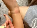 恩姆花园（带防伪码）恩姆花园止痒膏欧洲赤松舒缓魔法膏儿童宝宝婴儿蚊虫 实拍图