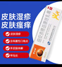 曲安奈德益康唑乳膏真菌感染脚气皮肤药抗真菌股癣专用药膏大腿内侧痒止痒抑菌皮肤瘙痒皮炎湿疹脱皮烂脚丫药 1盒【脱屑掉屑红斑瘙痒】*15.g赠棉签 实拍图