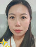 秋雅奈绪川字纹去除神器专用填充去男女重度法令纹抬头纹眉间皱纹睡觉贴膏 一盒体验装【男女通用】 男女抗皱紧致抗衰老悬针纹淡纹霜 实拍图