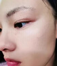 医用精华液械字号收缩毛孔粗大修复细致去黑头粉刺闭口男士女士祛痘印黑色素沉淀控油淡化痘印痘坑透明质酸钠 实拍图