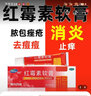 福元 红霉素软膏10g/支 红霉素软膏脓疱疮溃面感染痘痘痤疮皮肤化脓烫伤烧伤皮肤病感染 本品2盒+1包医用棉.签【搭配使用 预防感染】 实拍图