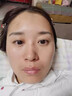 面瘫贴后遗症专用特傚口眼联动面肌痉挛嘴歪眼斜 单盒装【轻度适用】 实拍图