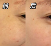 儒意（RUYI）淡纹眼霜30g淡化细纹眼纹抗皱提拉紧致黑眼圈祛抗护肤品眼袋衰老 实拍图