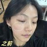 LA美国377祛斑霜美白淡化老年黄褐雀斑黑色素女男士护肤品去晒提亮 实拍图