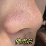 东洋之花硫磺洗面奶控油祛痘除螨虫去黑头深层清洁缩毛孔女男士专用洁面乳 实拍图