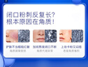 TAKAMI小蓝瓶精华液60ml角质修护祛痘祛闭口补水敏感肌护肤品生日礼物 实拍图
