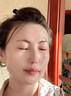 希格玛308白癜风治疗仪西格玛UVB银屑病紫外线准分子激光光疗仪医院同款 12强度308nm全身小面积可用 实拍图