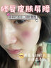 透真油橄榄修复精华液皮肤屏障受损泛红敏感舒缓修护原液祛痘收缩毛孔 实拍图