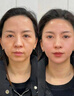 OHBT黄芪霜60g老国货保湿焕白去黄提亮抗皱紧致抗衰面霜男女护肤品 实拍图