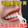 迪福伦成人儿童洁牙擦牙齿橡皮擦去牙垢黑牙渍牙菌斑微米洁牙擦祛除烟渍 灭菌纳米洁牙擦（15支装/盒） 实拍图