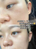 同仁堂（TRT）祛斑美白淡化黑色素烟酰胺凝胶祛斑霜去斑专用男女50g  实拍图
